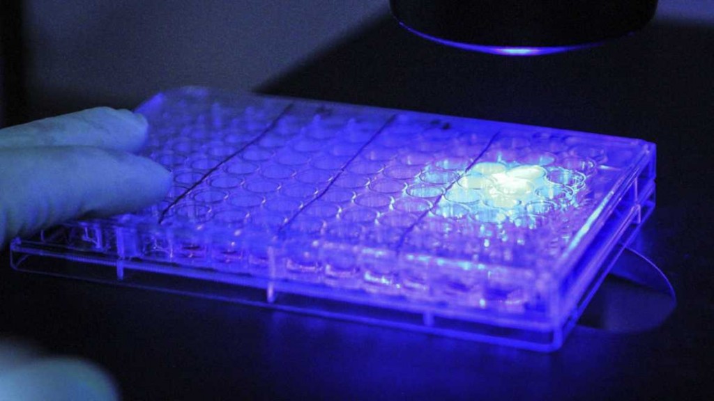 Un líquido inyectable ilumina las células cancerosas para facilitar su extracción