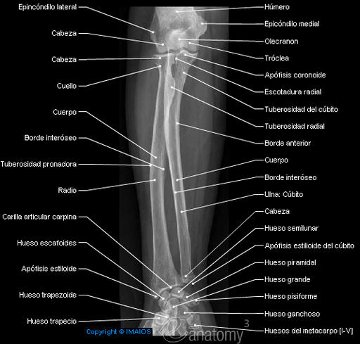 Radiología de antebrazo
