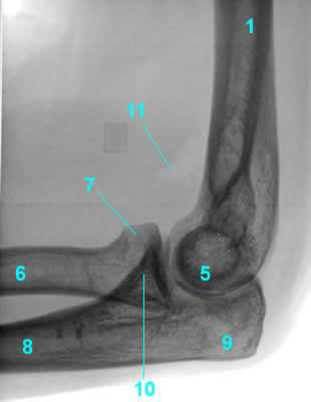 Radiología e Imagen para el Diagnóstico: mayo 2017